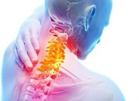 Pain and shelters in the Grlić zone with a third degree of osteochondrose