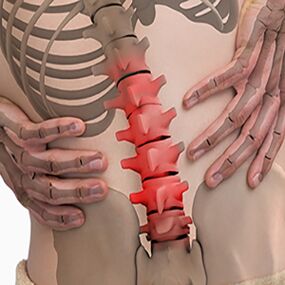 Osteochondrosis of the lumbar spine