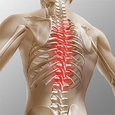 Osteochondrosis of the thoracic spine