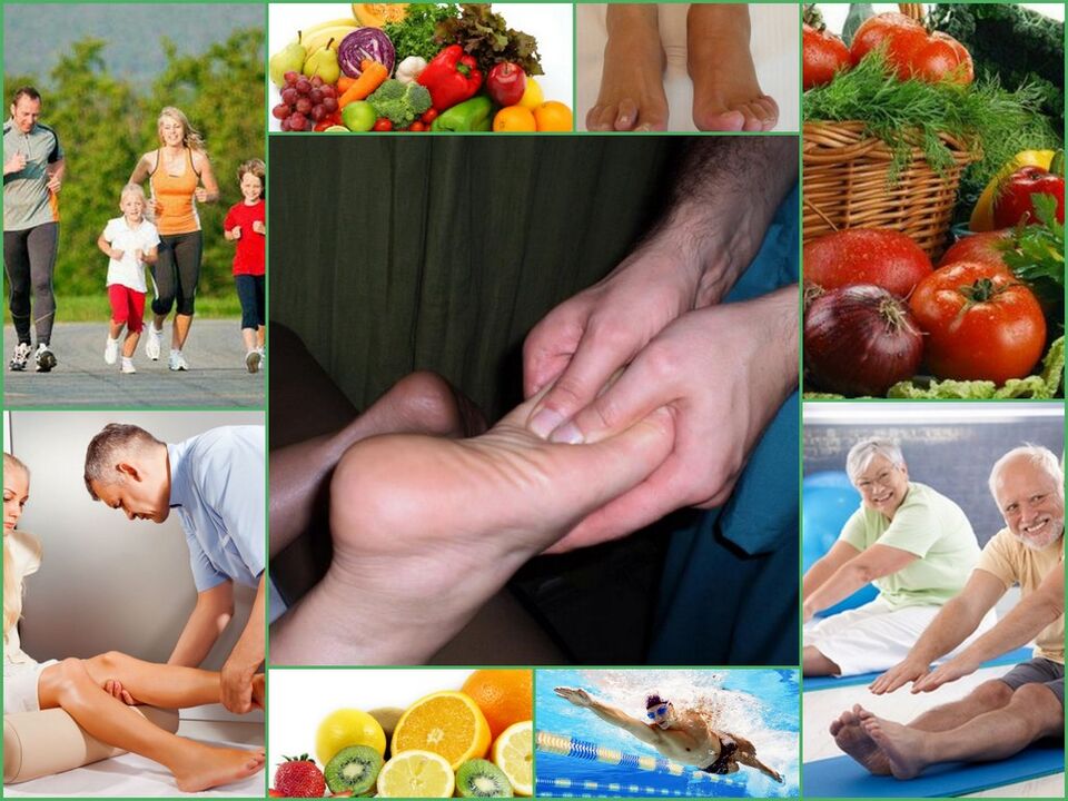 Arthrosis of knee joint prevention